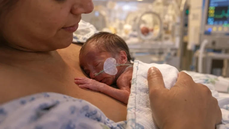 Bebê prematuro em contato pele a pele com a mãe pelo método canguru em UTI neonatal.