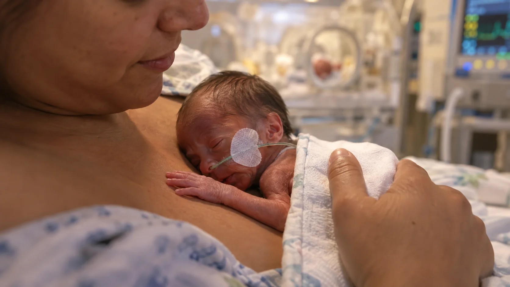 Bebê prematuro em contato pele a pele com a mãe pelo método canguru em UTI neonatal.